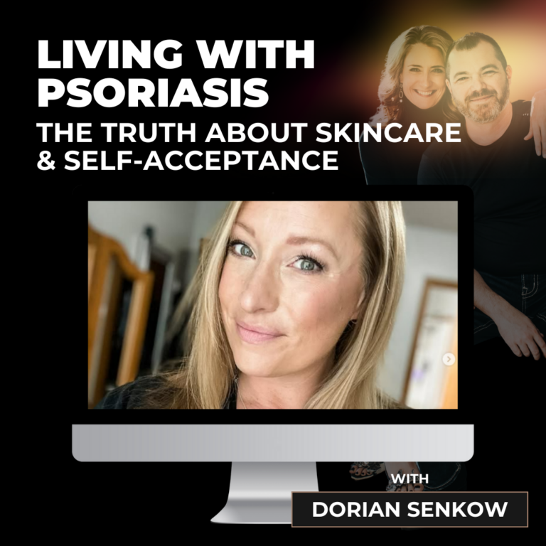 Living with Psoriasis